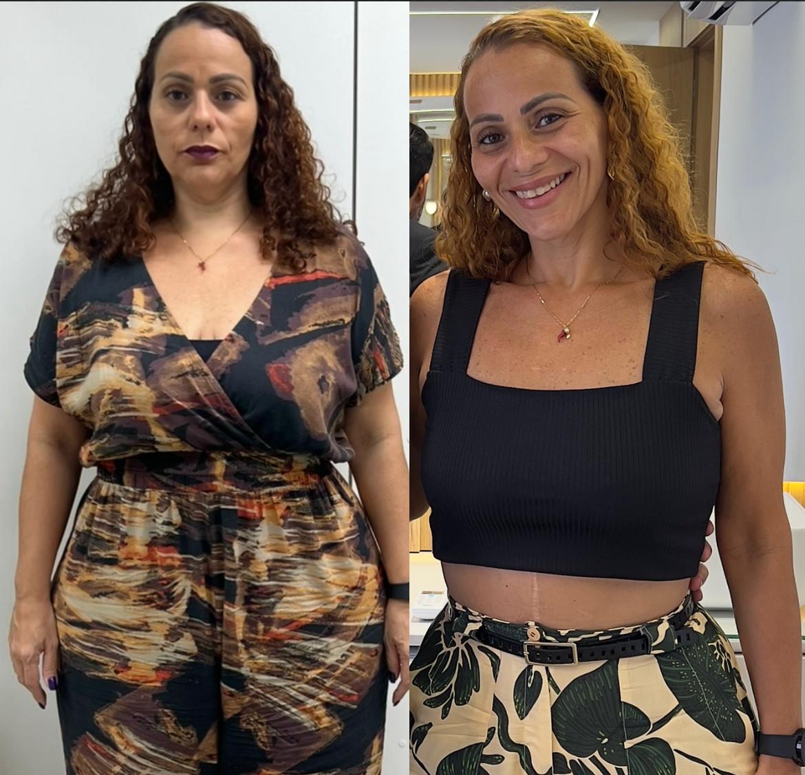 Antes e depois de Ângela com o Método PESE